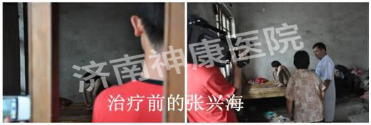 治疗前的张兴海